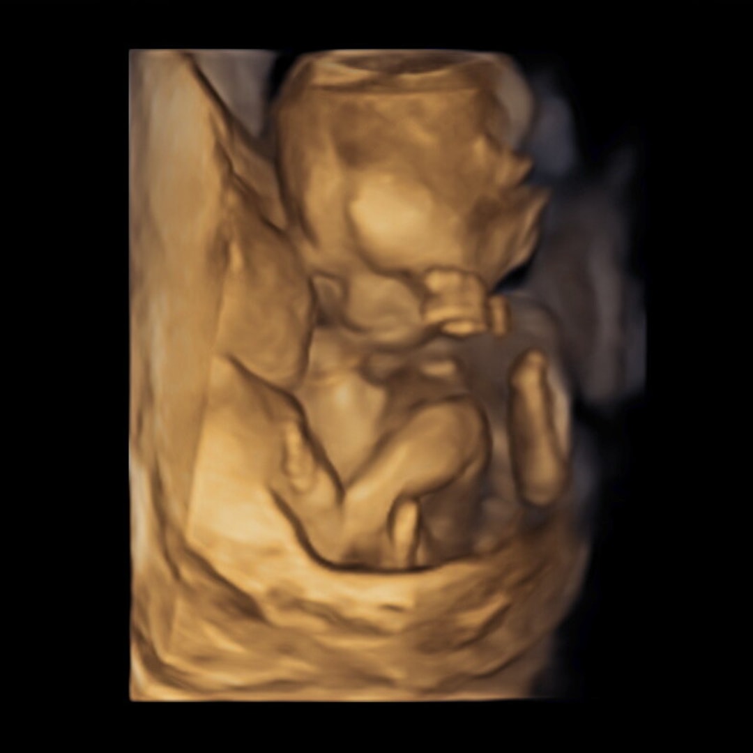 Photo shared by Grace for their Babylist baby registry.