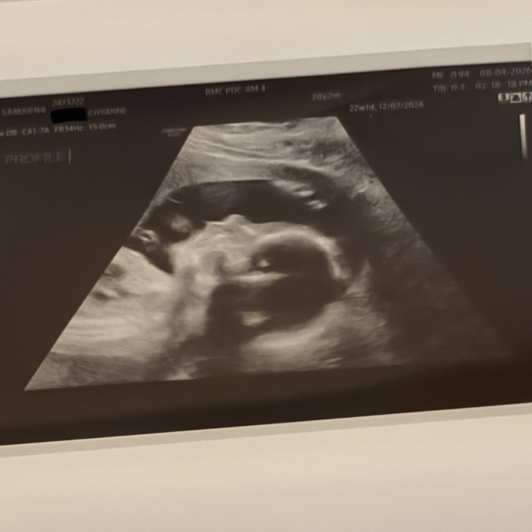 Photo shared by Chyanne for their Babylist baby registry.