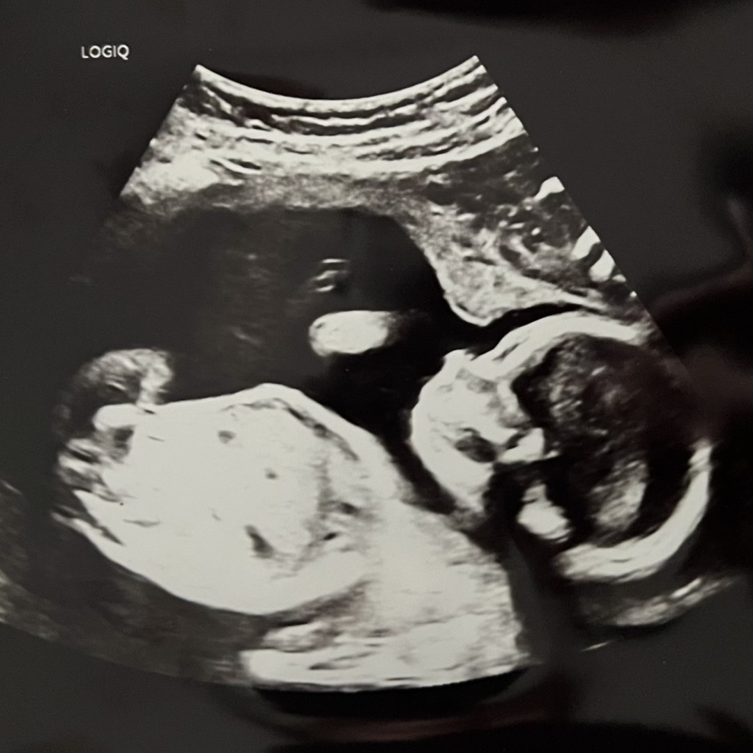 Photo shared by Alyxandrea for their Babylist baby registry.
