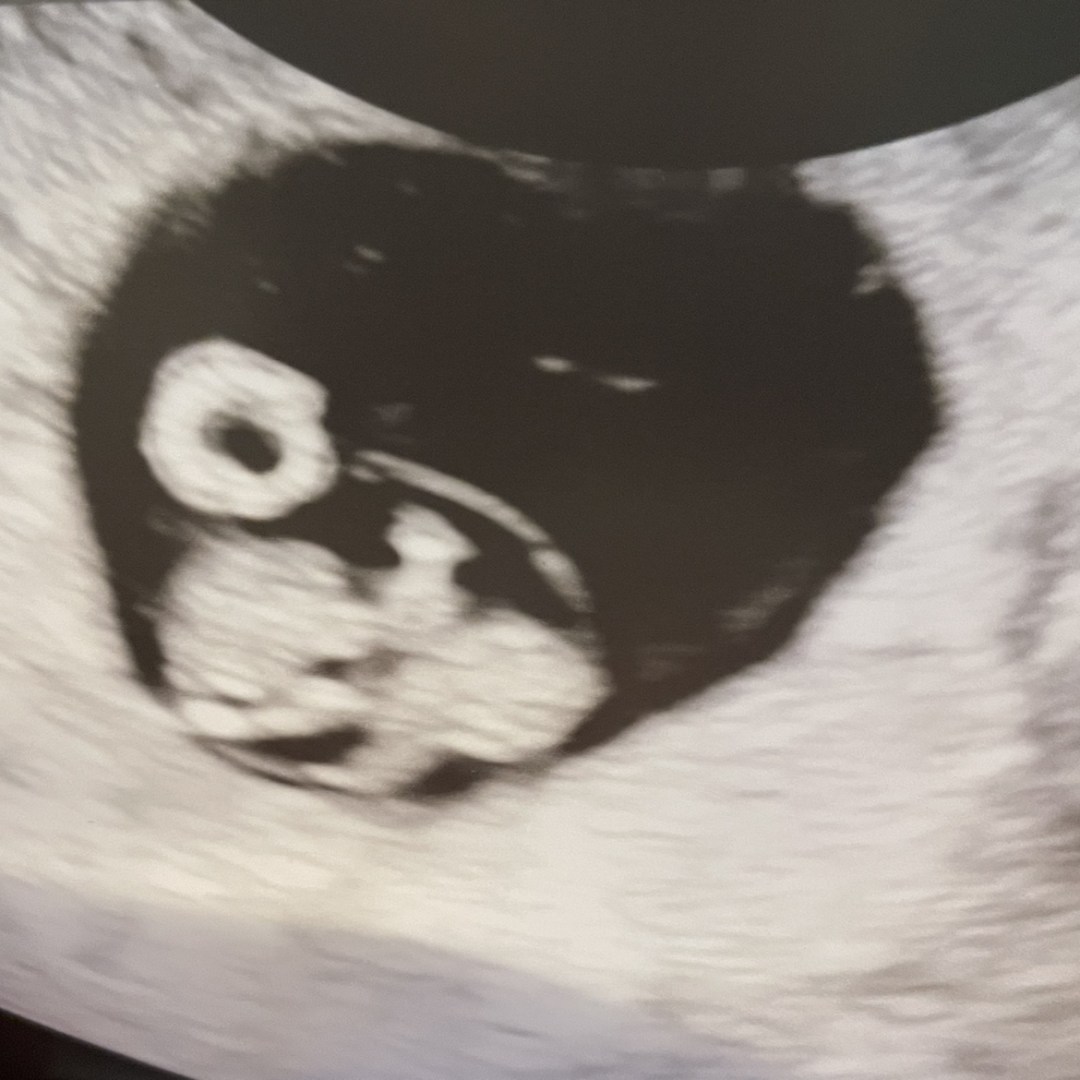 Photo shared by Grace for their Babylist baby registry.
