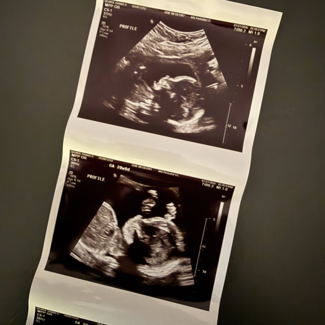 Photo shared by Hanna for their Babylist baby registry.