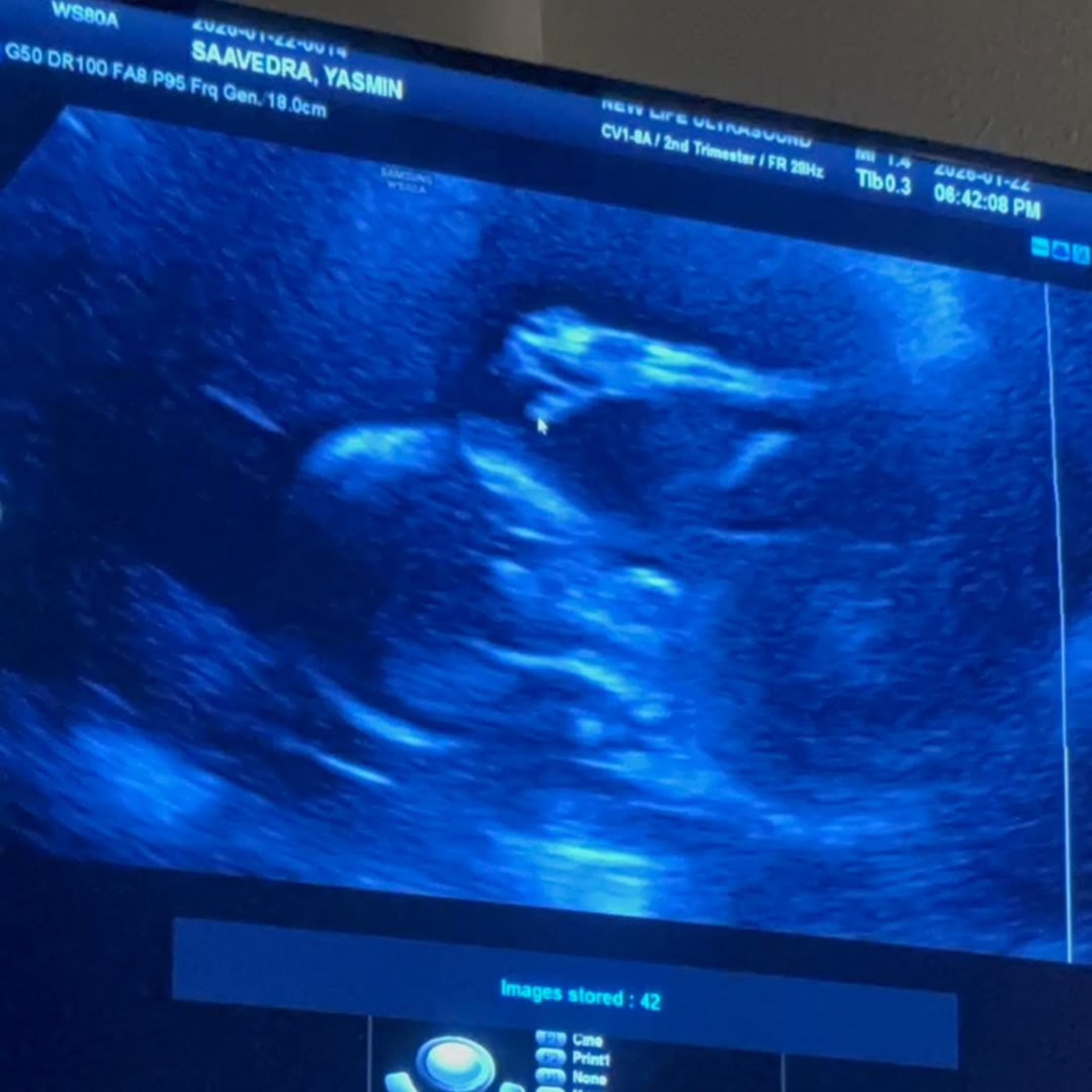 Photo shared by Yasmin for their Babylist baby registry.