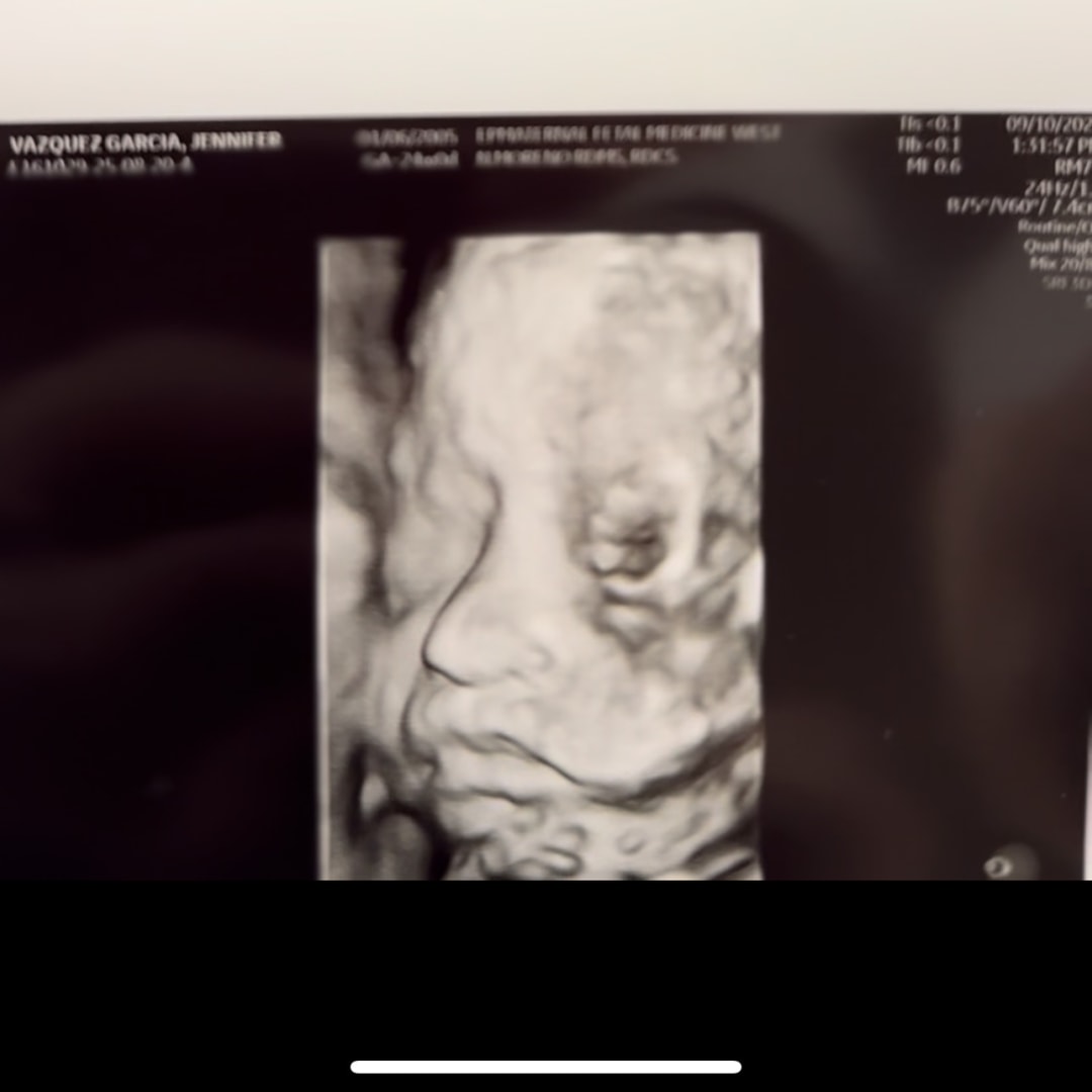 Photo shared by Jennifer for their Babylist baby registry.