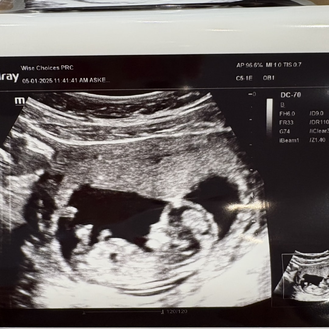 Photo shared by Carlee for their Babylist baby registry.