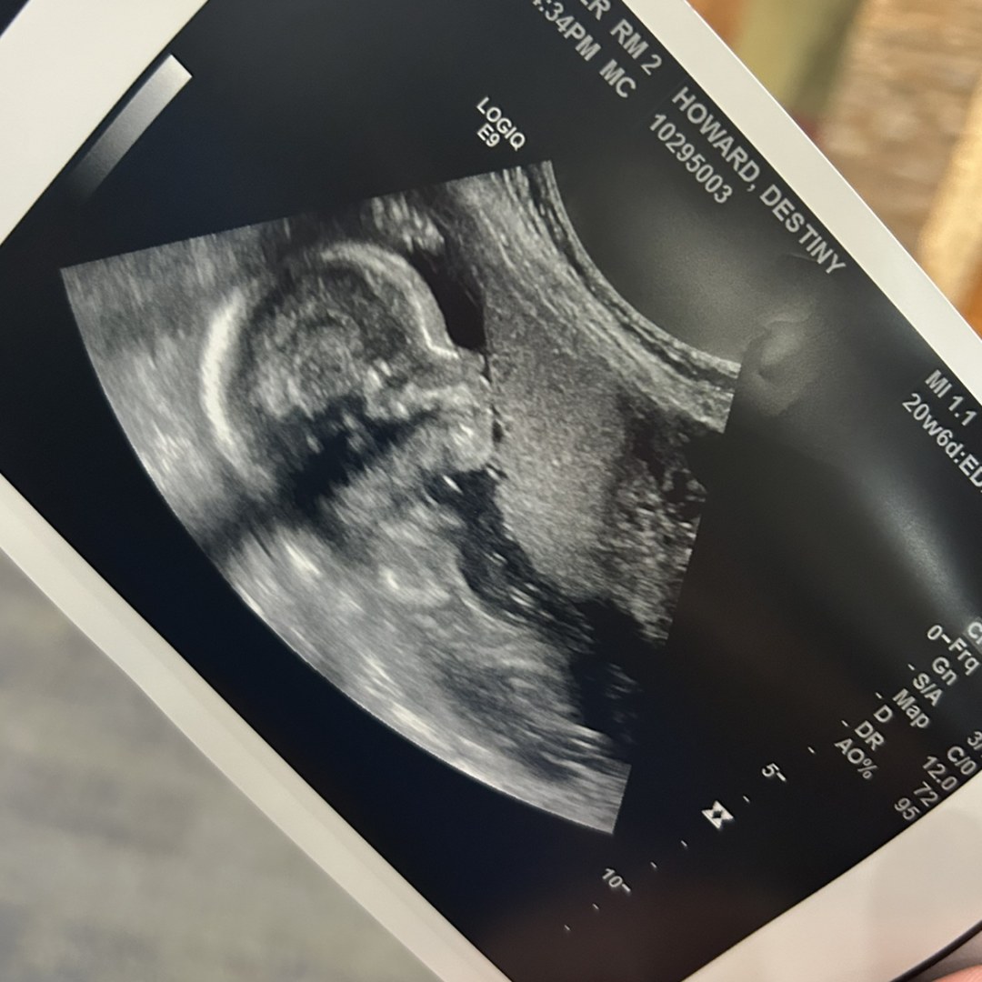 Photo shared by Destiny for their Babylist baby registry.