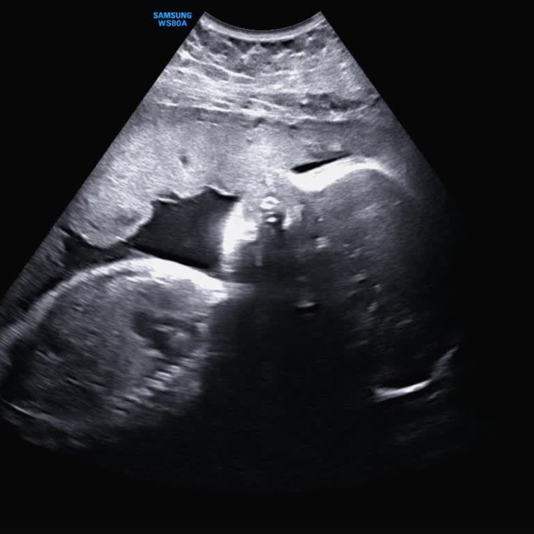 Photo shared by Brandi for their Babylist baby registry.