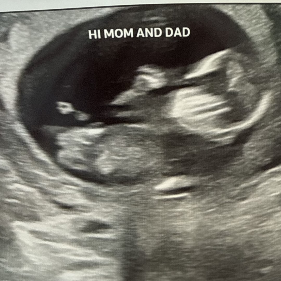 Photo shared by Maeghan for their Babylist baby registry.