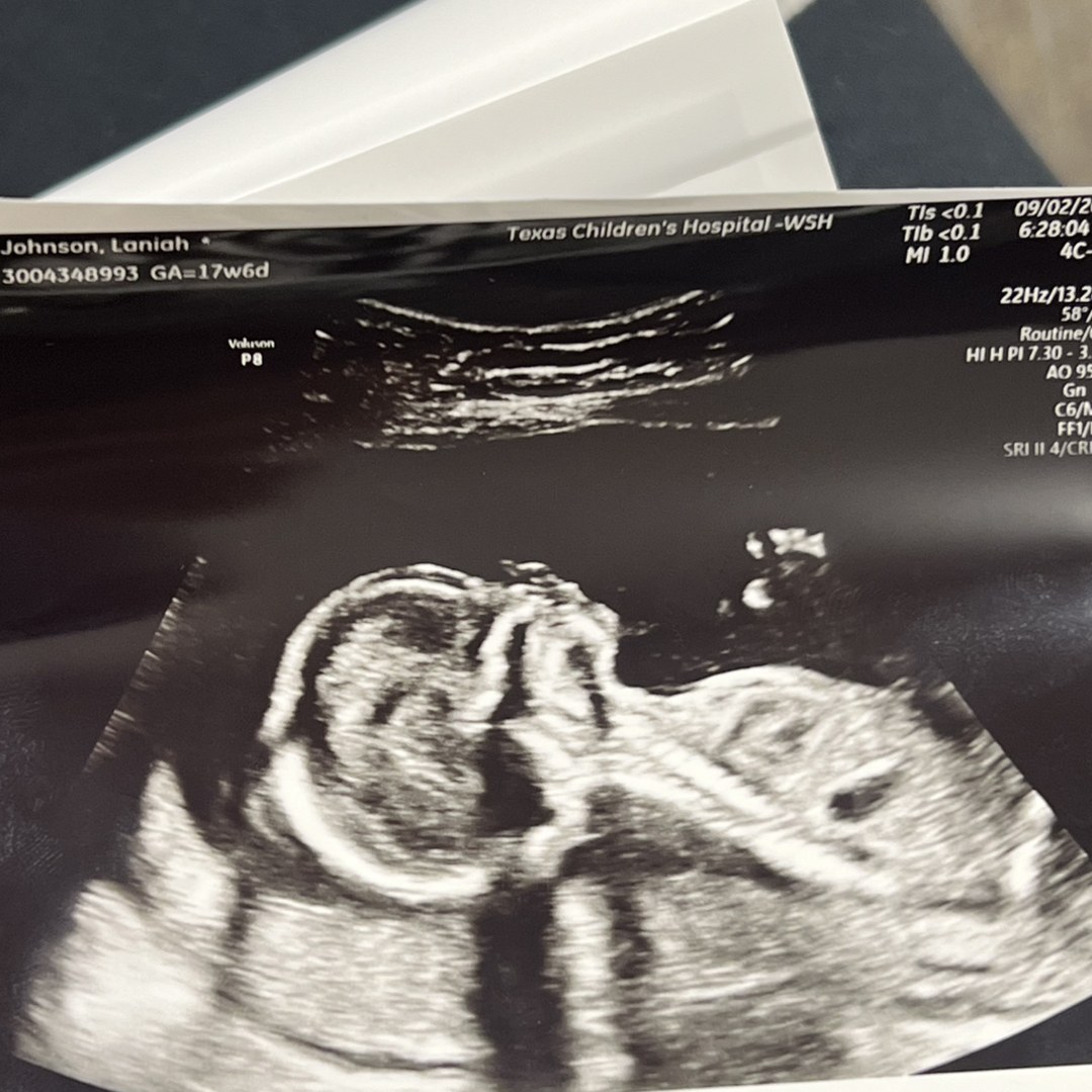 Photo shared by Laniah for their Babylist baby registry.