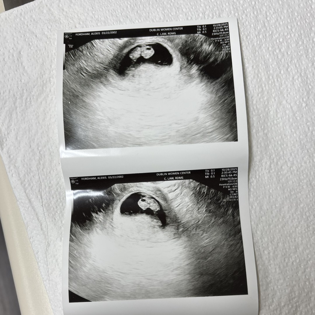 Photo shared by Alexis for their Babylist baby registry.