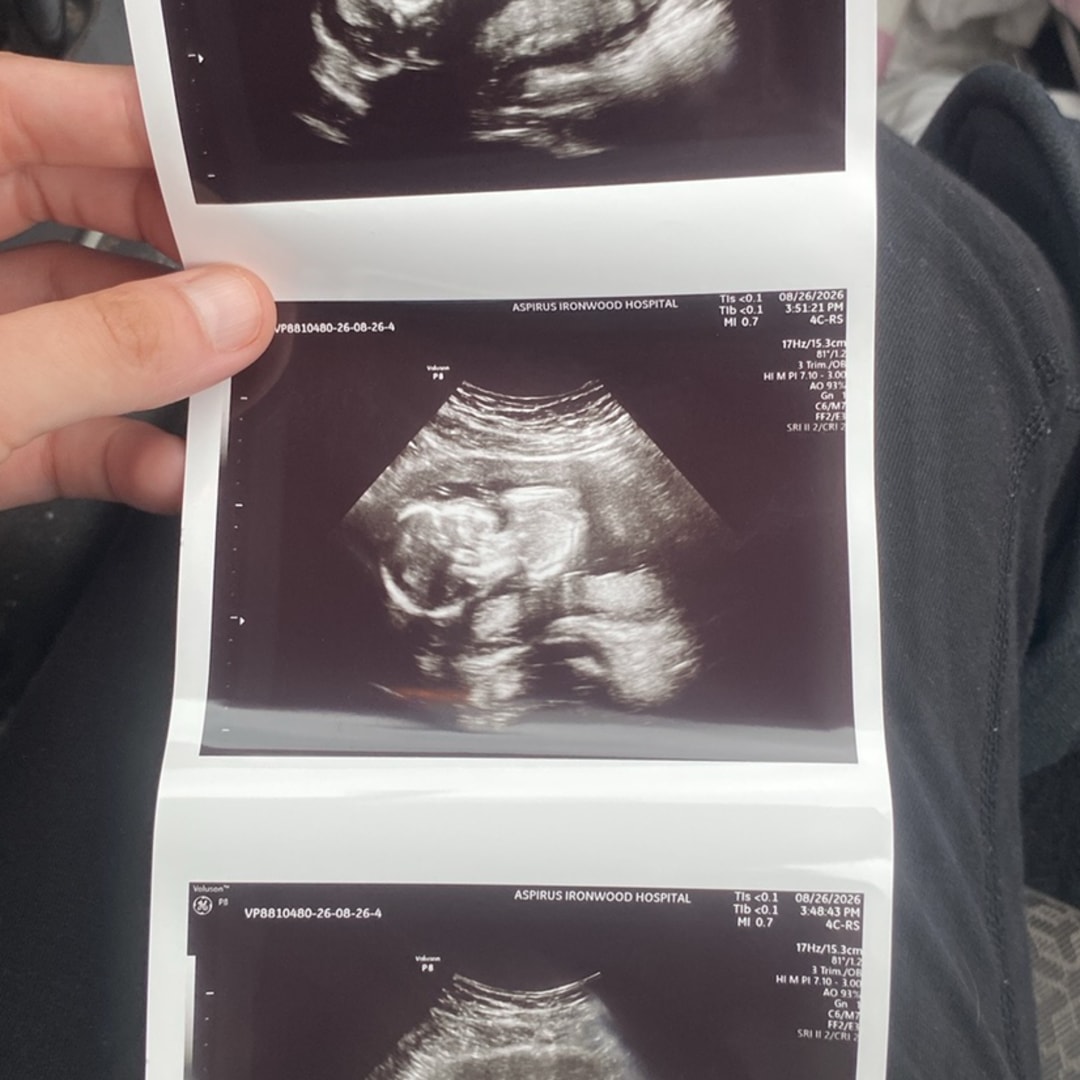 Photo shared by Estella for their Babylist baby registry.