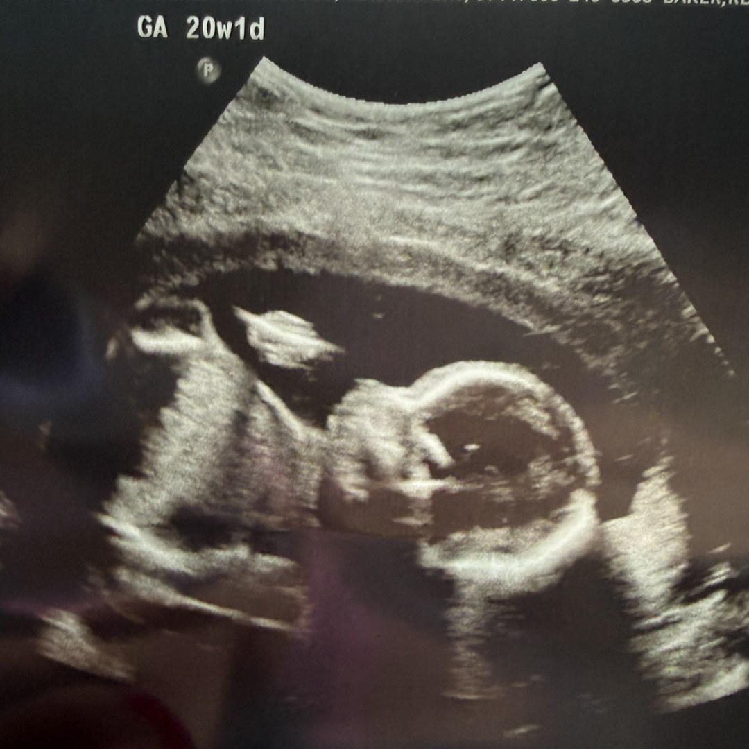 Photo shared by Brianna for their Babylist baby registry.
