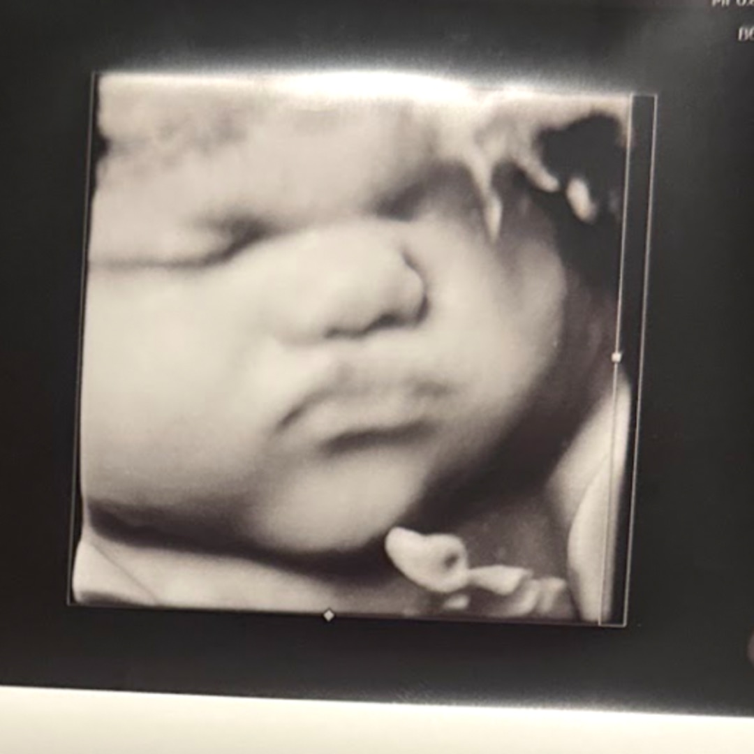 Photo shared by Jomar for their Babylist baby registry.