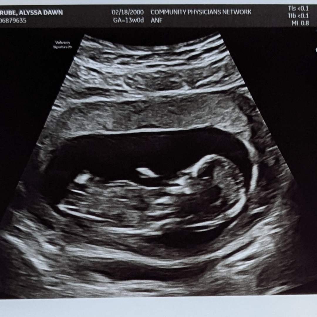 Photo shared by Alyssa for their Babylist baby registry.