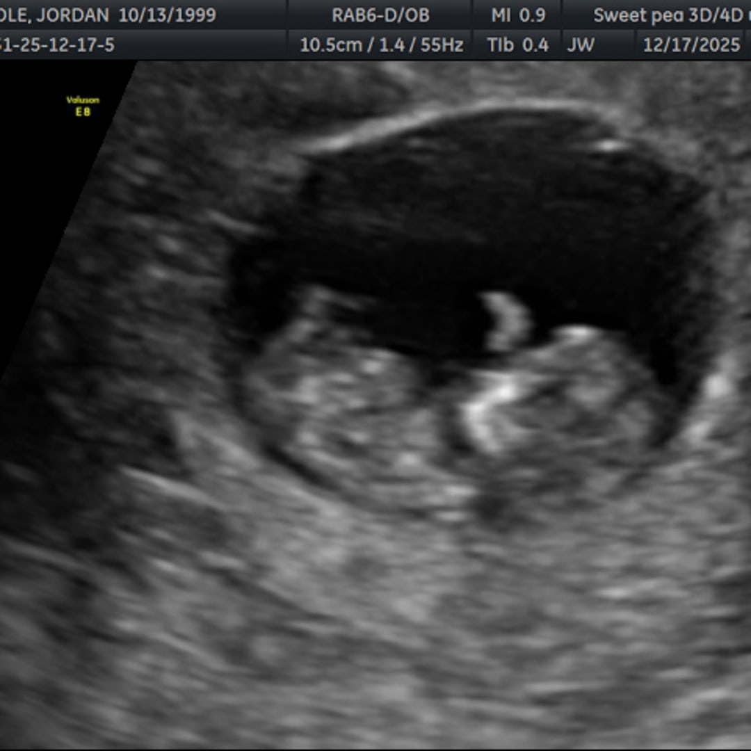 Photo shared by Jordan for their Babylist baby registry.