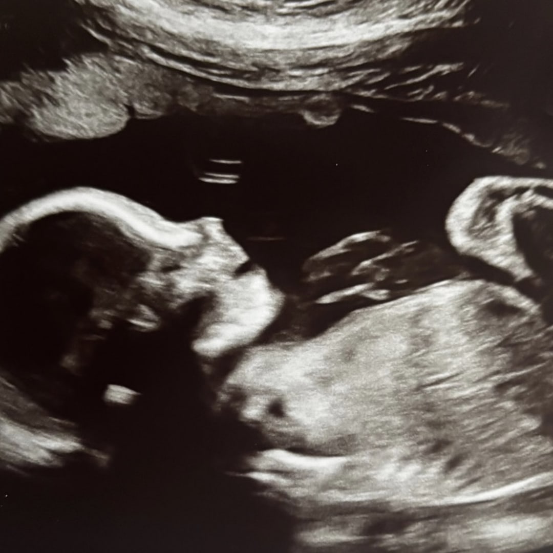 Photo shared by Jung for their Babylist baby registry.