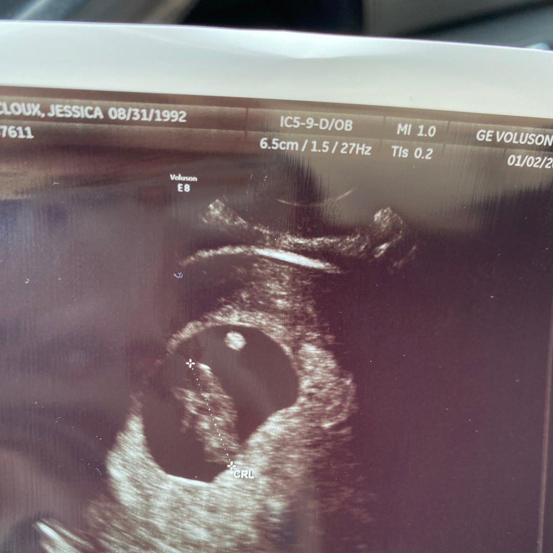 Photo shared by Jessica for their Babylist baby registry.