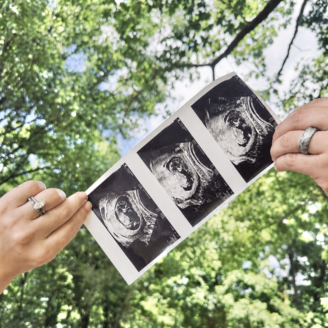 Photo shared by Savannah for their Babylist baby registry.