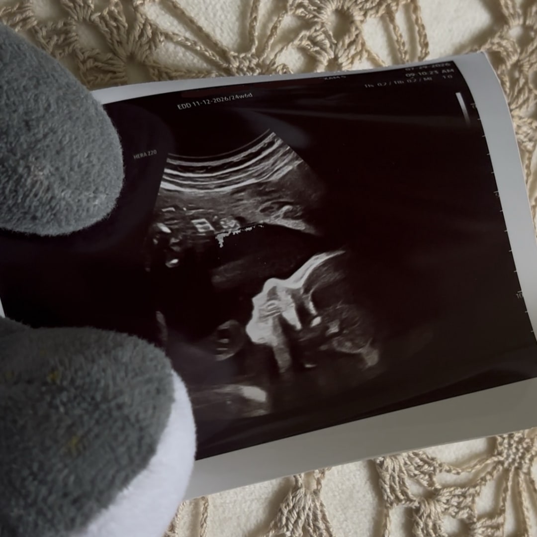 Photo shared by Alicija for their Babylist baby registry.