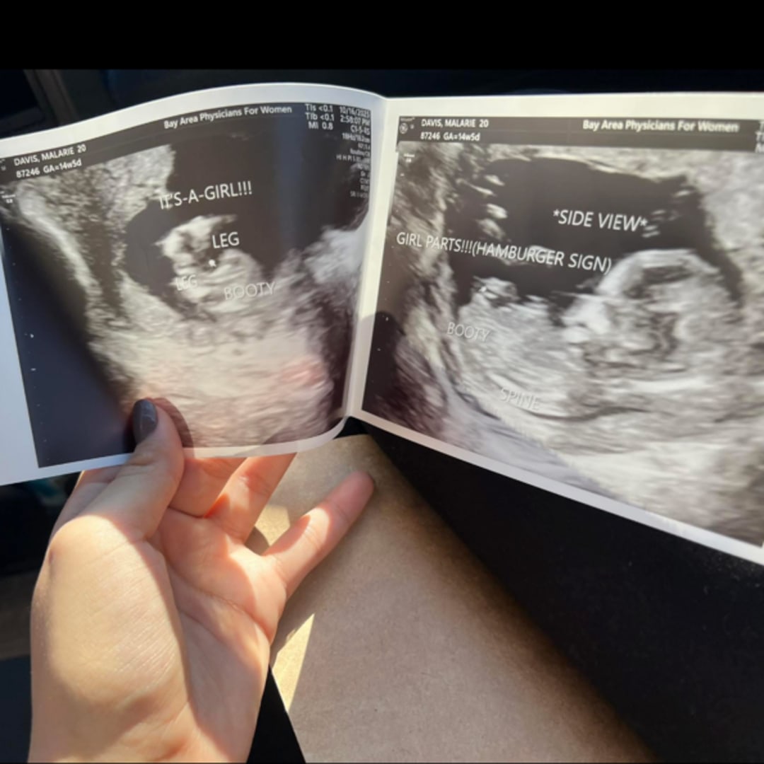 Photo shared by Malarie for their Babylist baby registry.