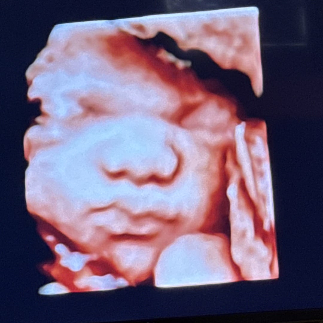 Photo shared by Vicky for their Babylist baby registry.