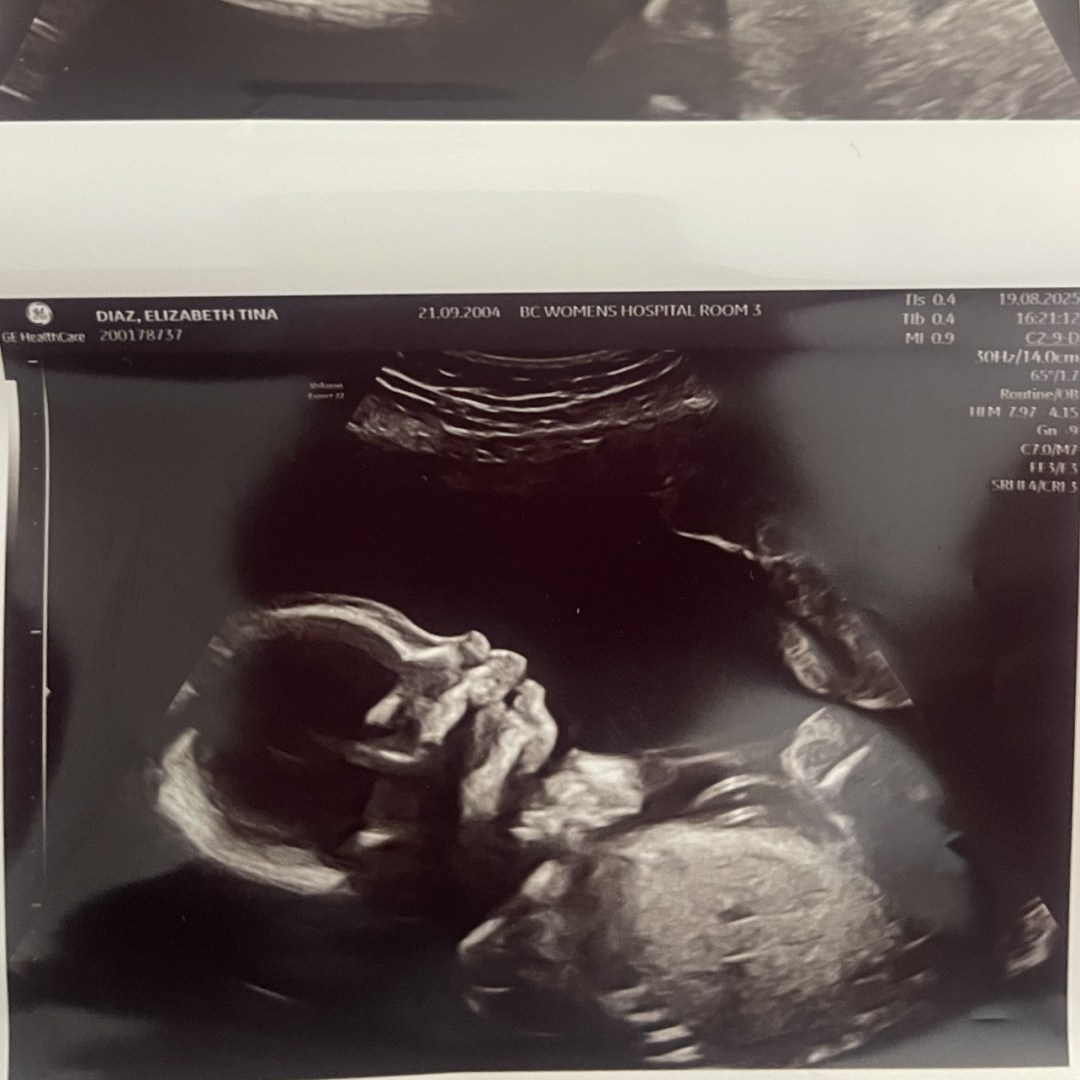 Photo shared by Elizabeth for their Babylist baby registry.
