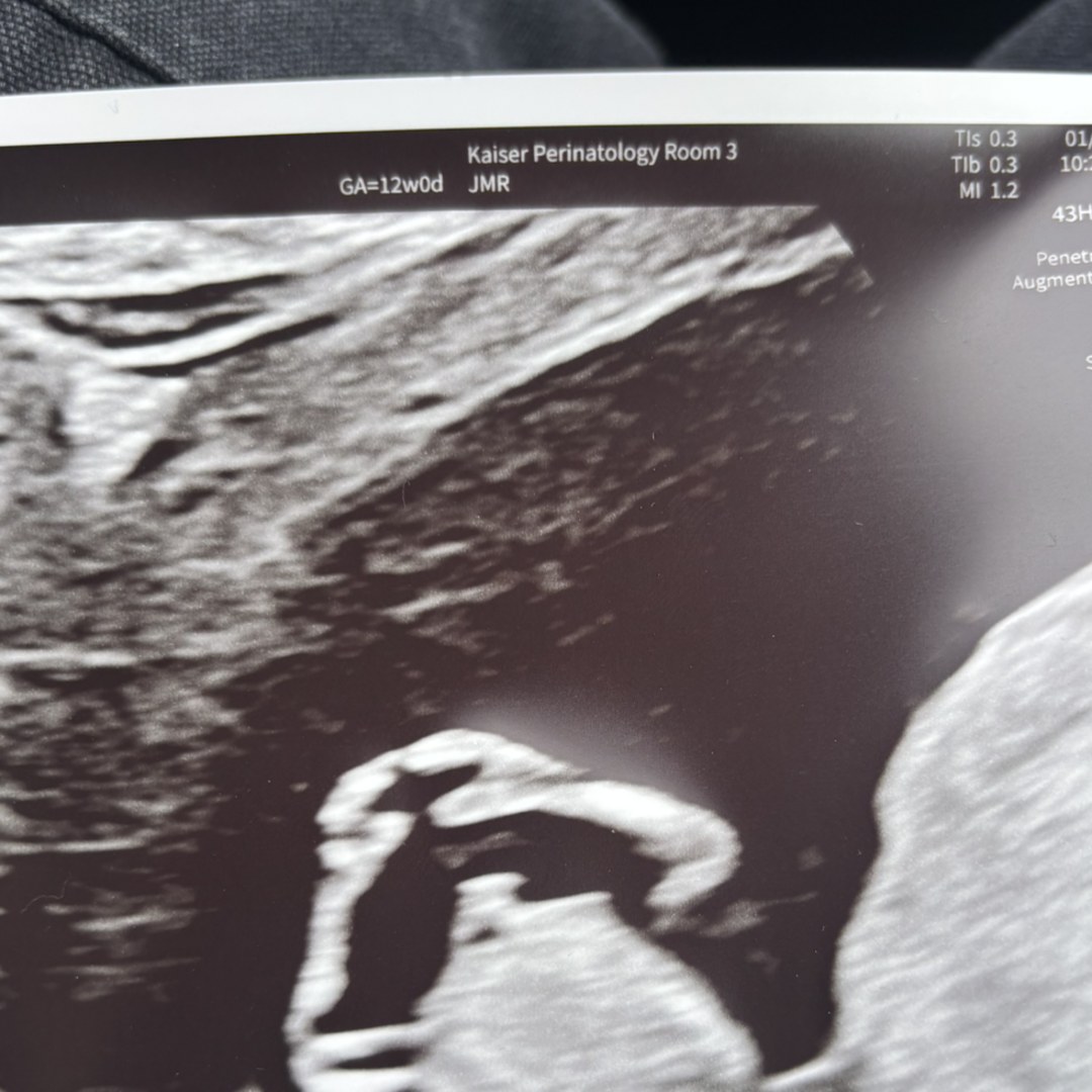 Photo shared by Elizabeth for their Babylist baby registry.