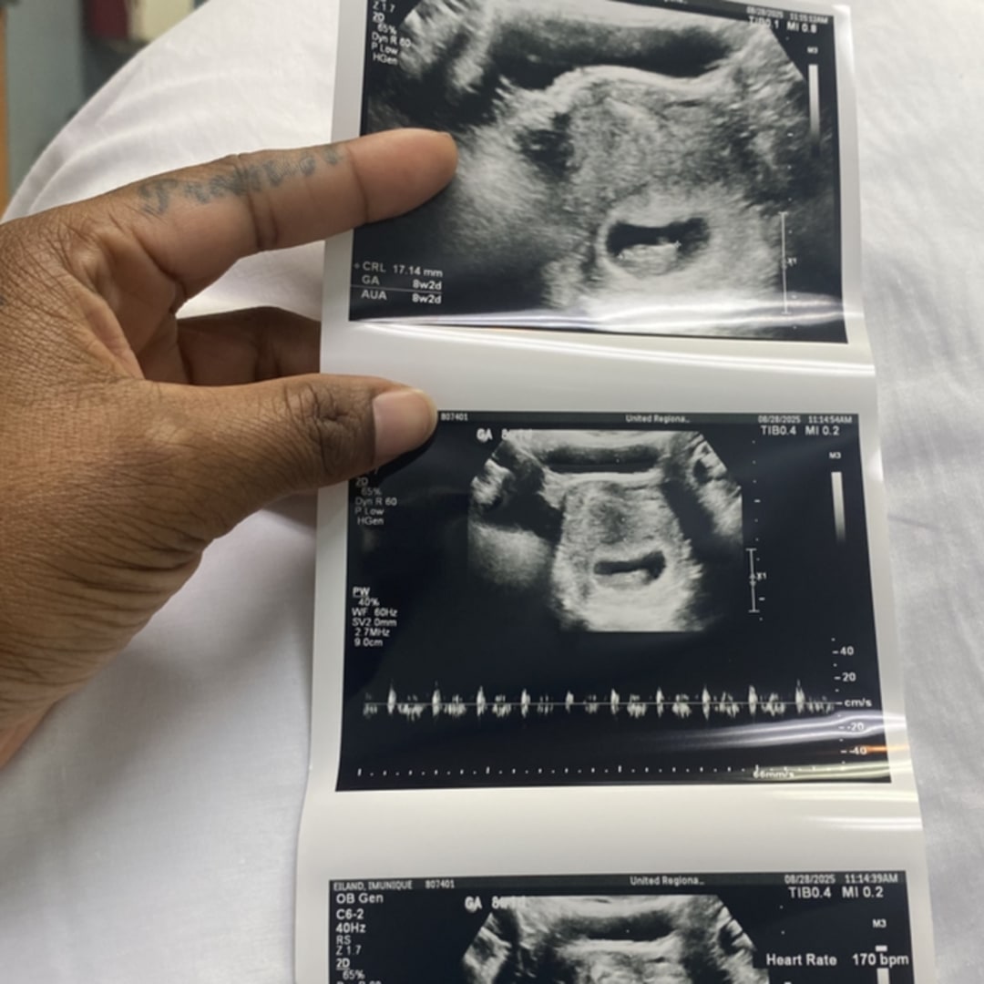 Photo shared by Imunique for their Babylist baby registry.