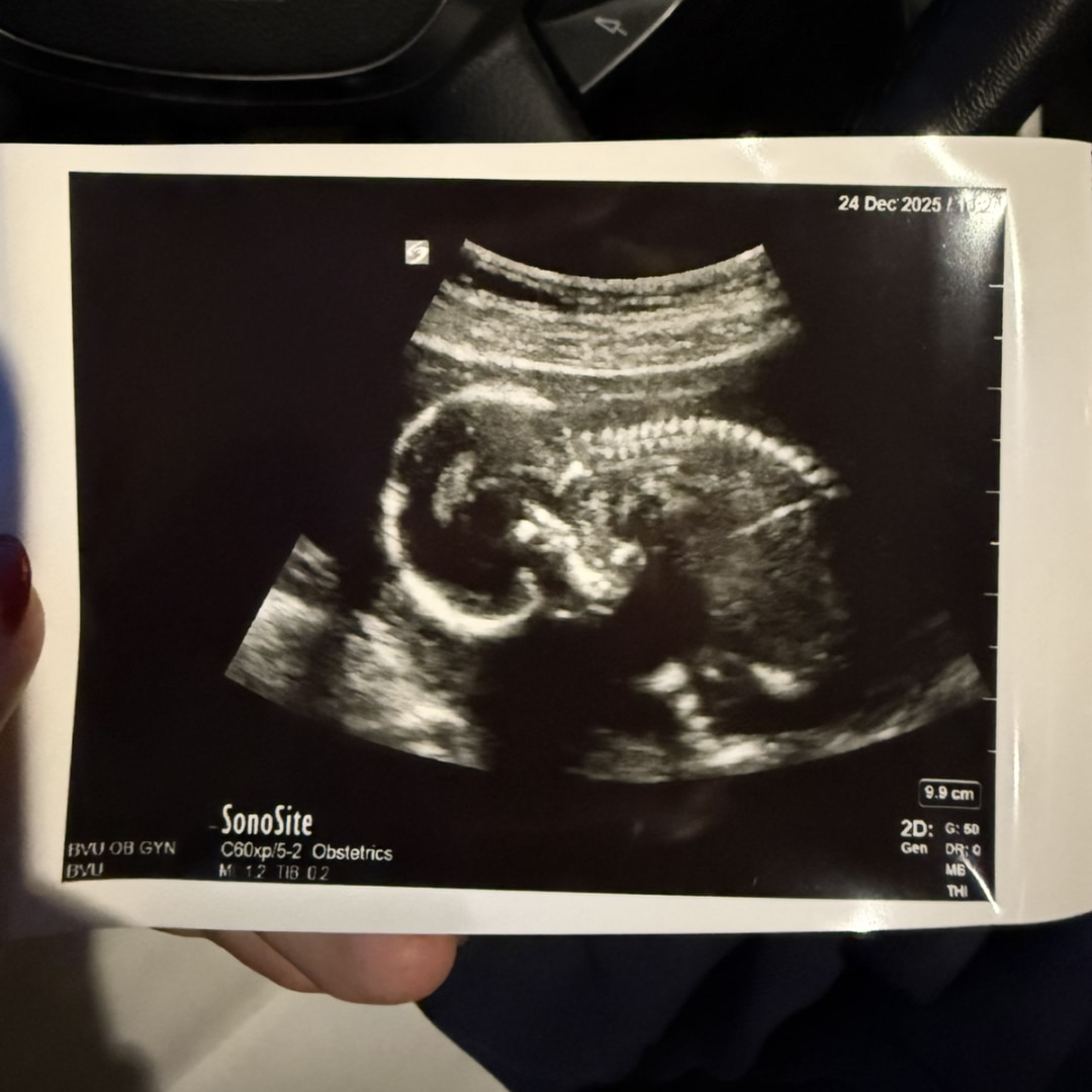 Photo shared by Isabella for their Babylist baby registry.