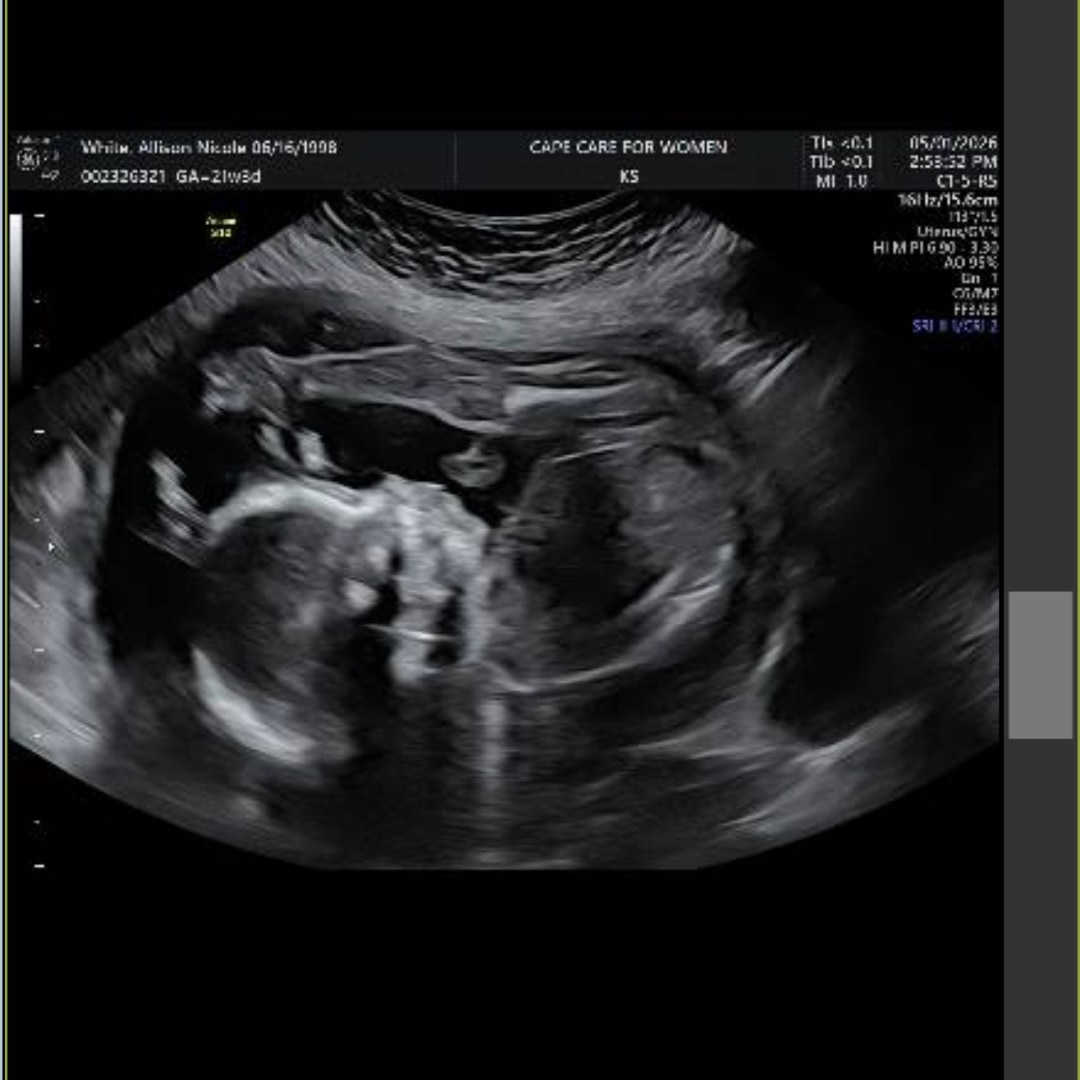 Photo shared by Allison for their Babylist baby registry.