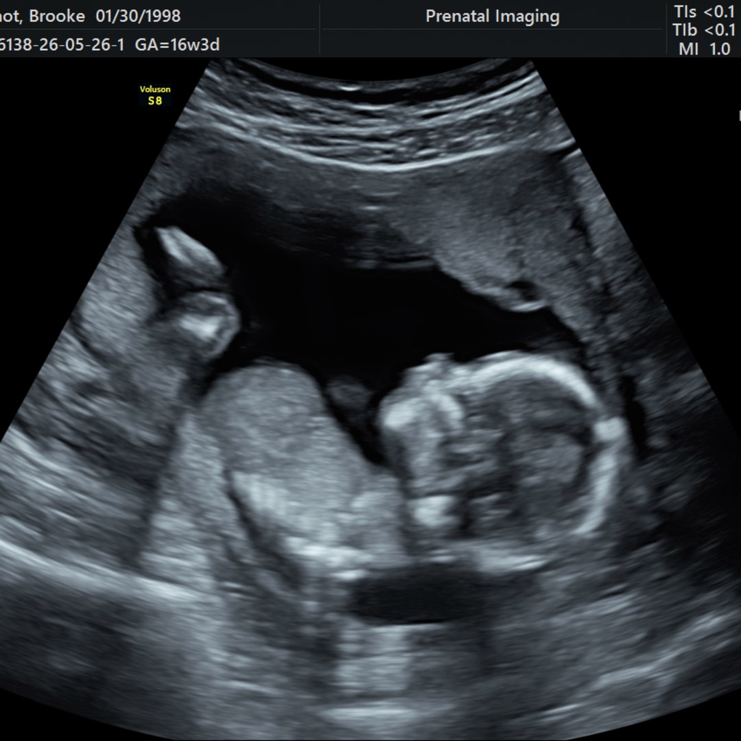 Photo shared by Brooke for their Babylist baby registry.