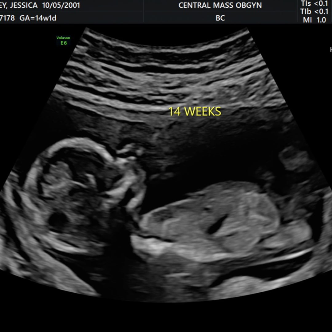 Photo shared by Jessica for their Babylist baby registry.
