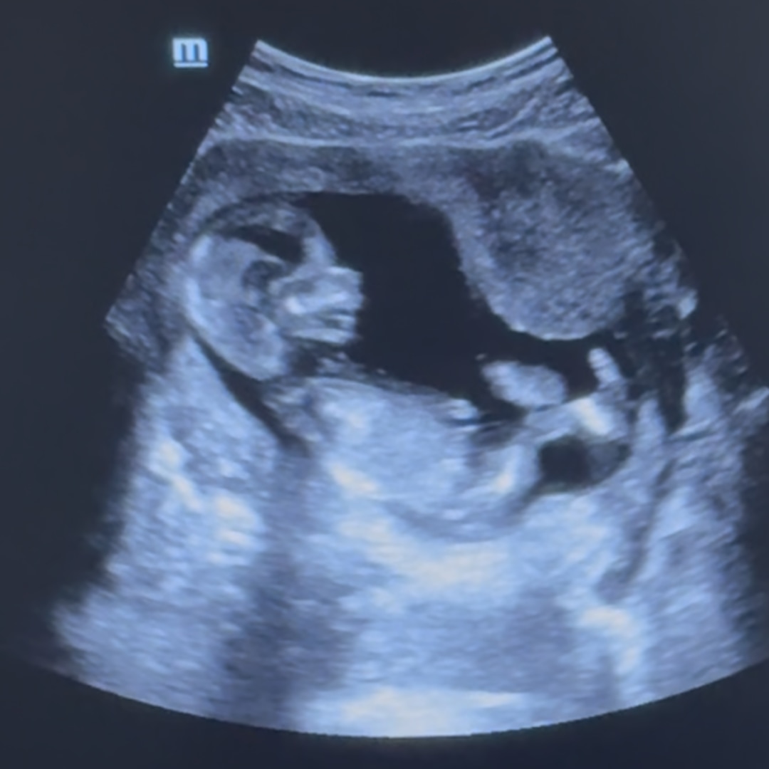 Photo shared by Brittney for their Babylist baby registry.