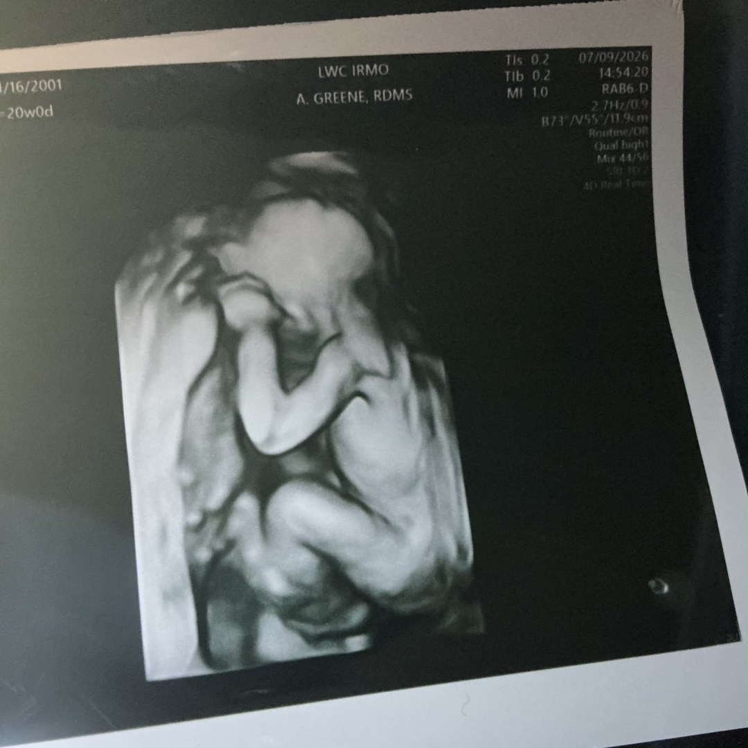 Photo shared by Janaa for their Babylist baby registry.