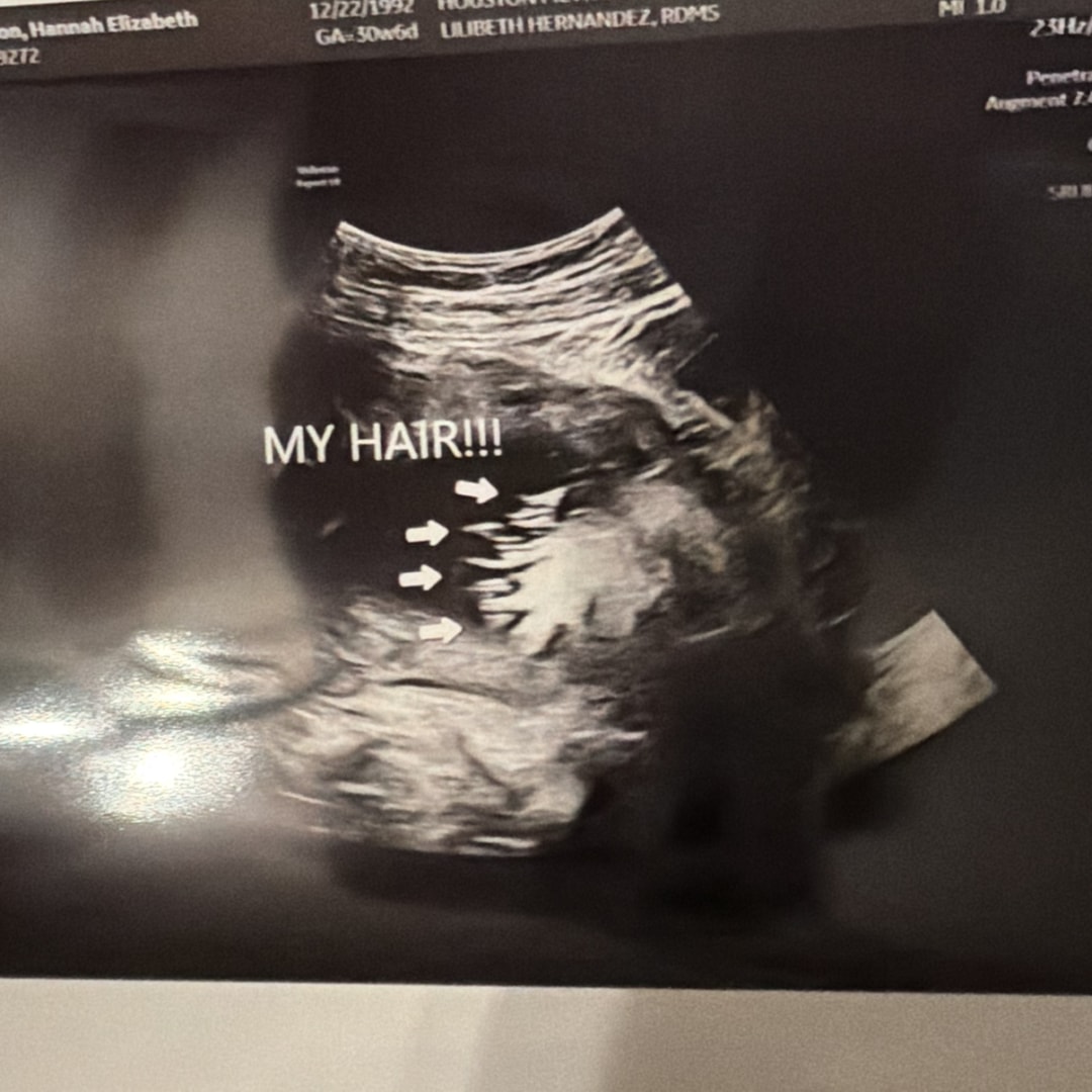 Photo shared by Hannah for their Babylist baby registry.