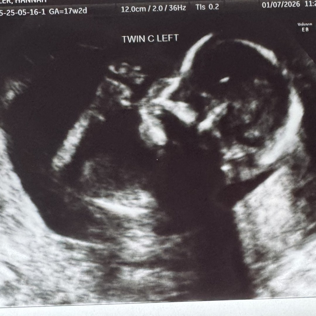 Photo shared by Gary for their Babylist baby registry.