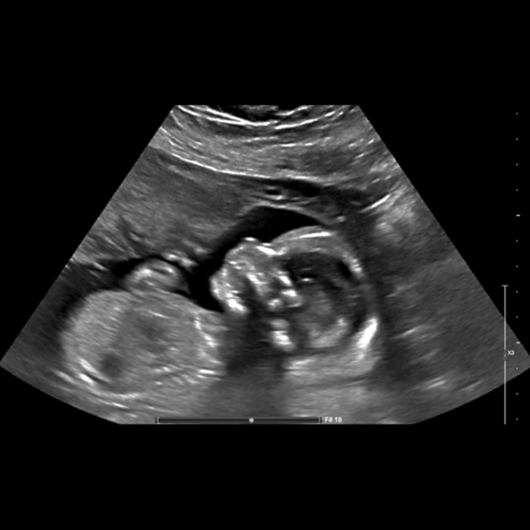 Photo shared by Erica for their Babylist baby registry.