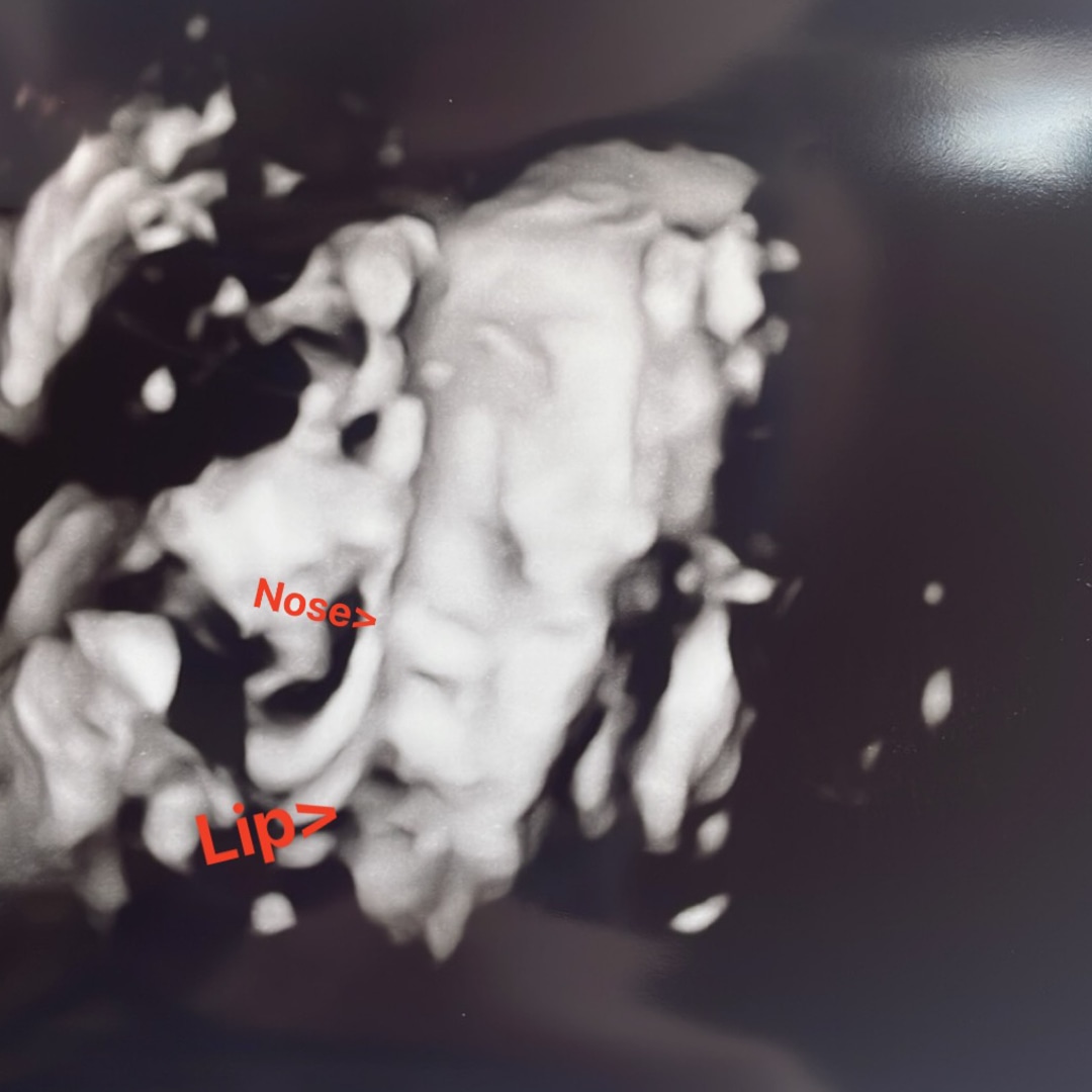 Photo shared by Hope for their Babylist baby registry.