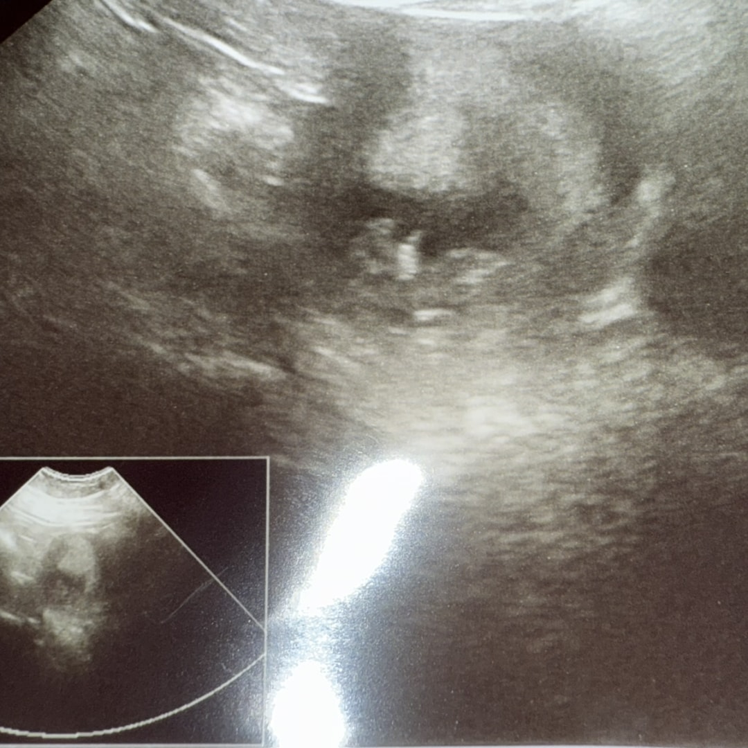 Photo shared by Lindsey for their Babylist baby registry.