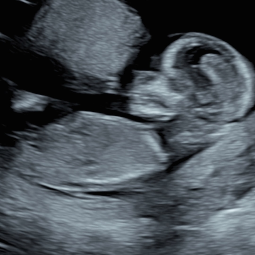 Photo shared by Alicia for their Babylist baby registry.