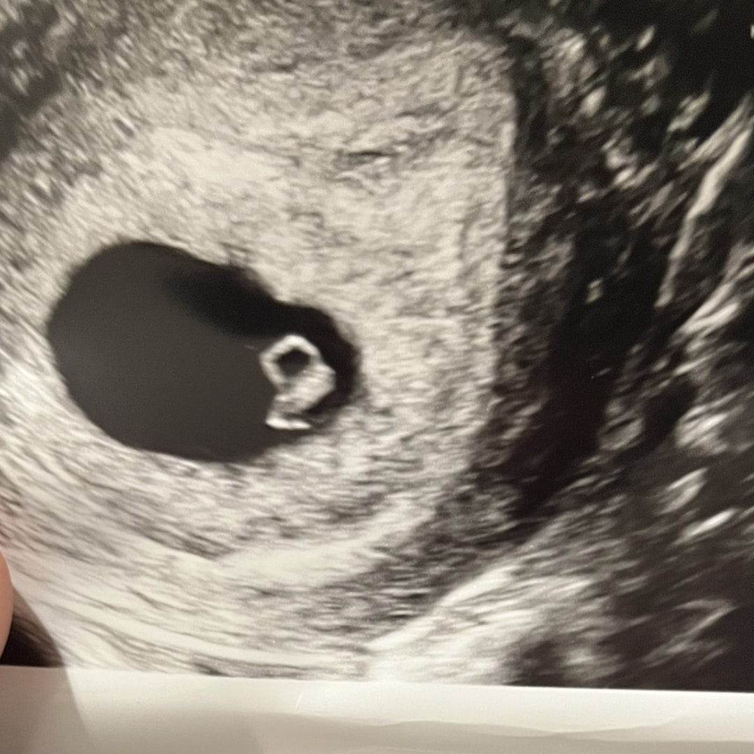 Photo shared by Milana for their Babylist baby registry.