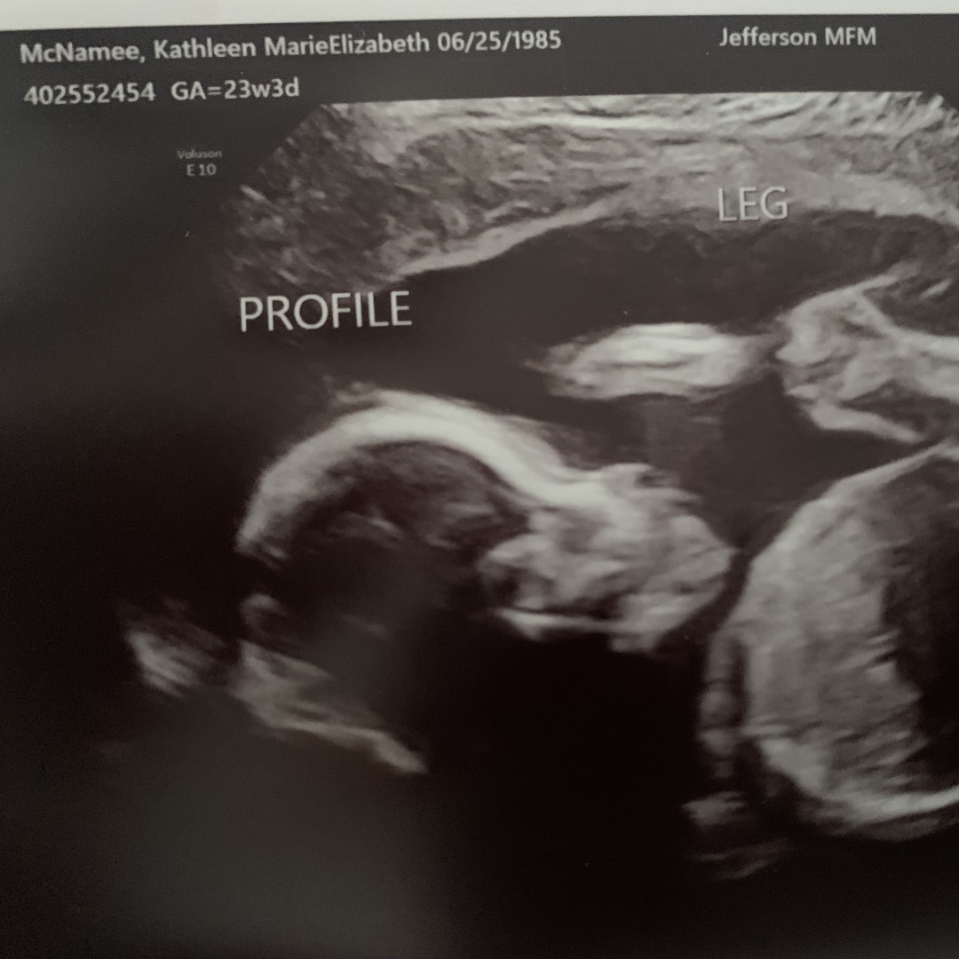 Photo shared by Katie for their Babylist baby registry.