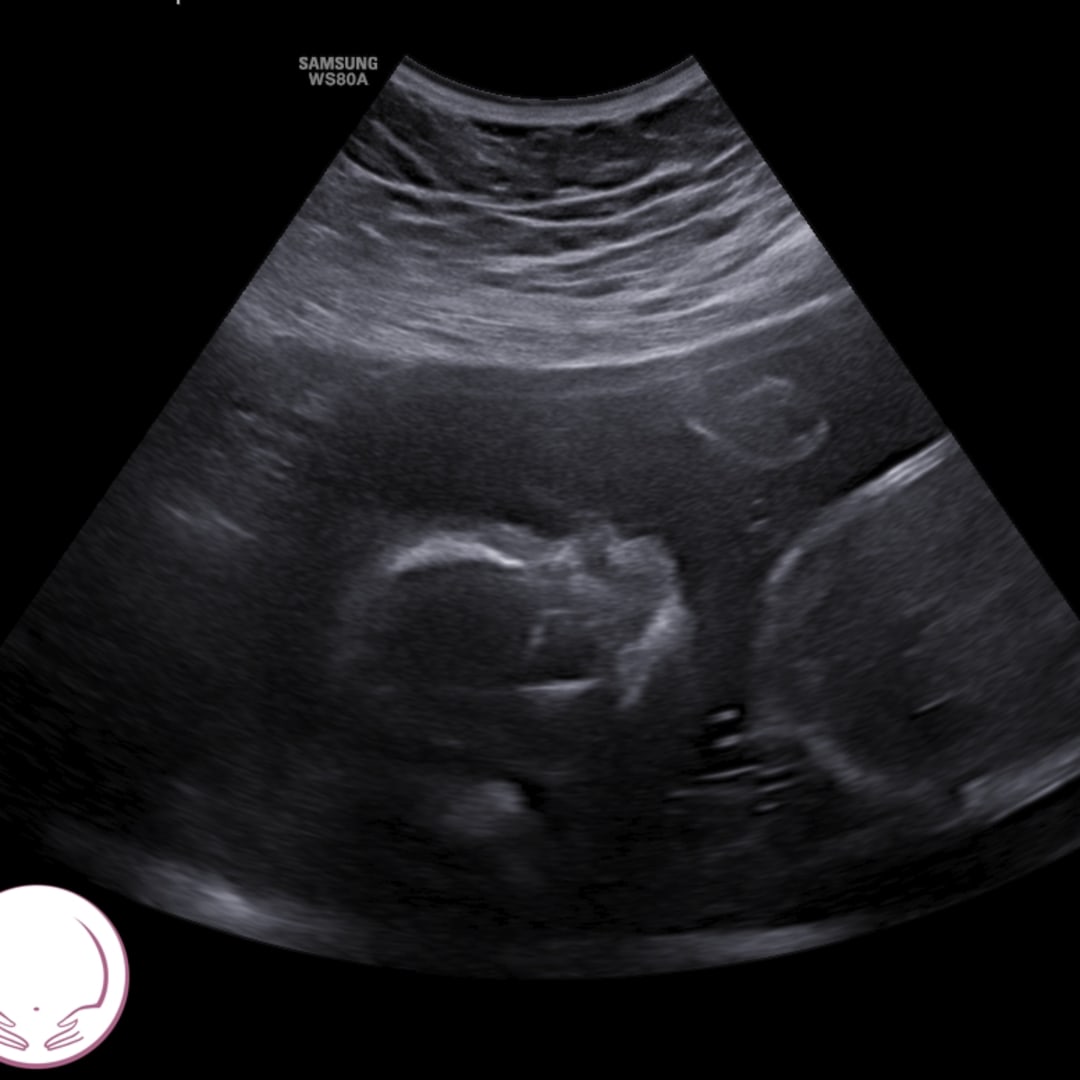 Photo shared by Maya for their Babylist baby registry.