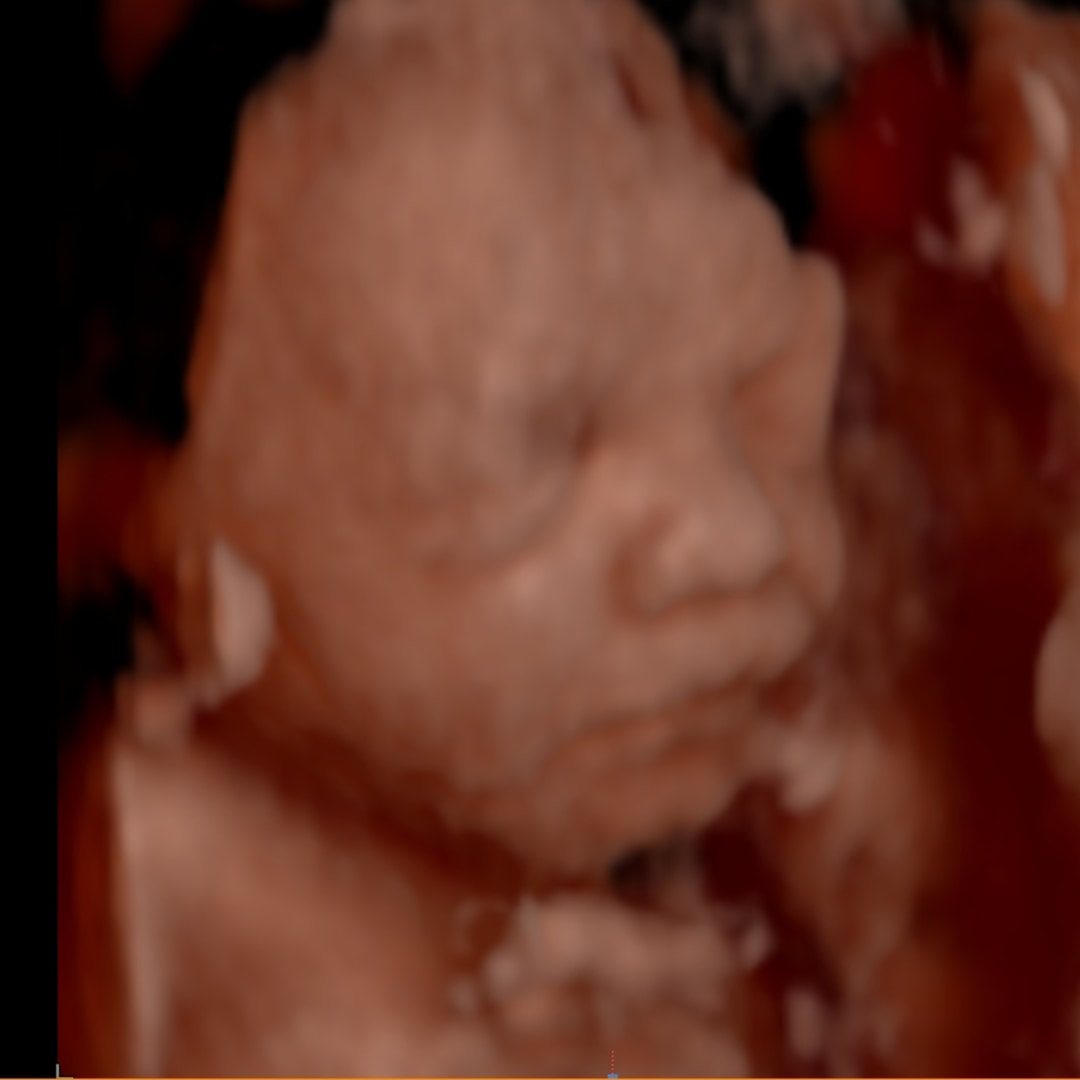 Photo shared by Abby for their Babylist baby registry.