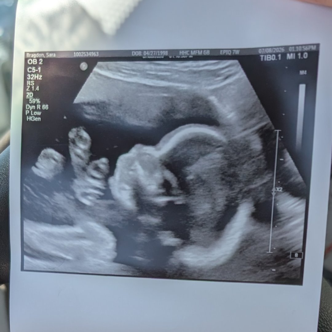 Photo shared by Sara for their Babylist baby registry.