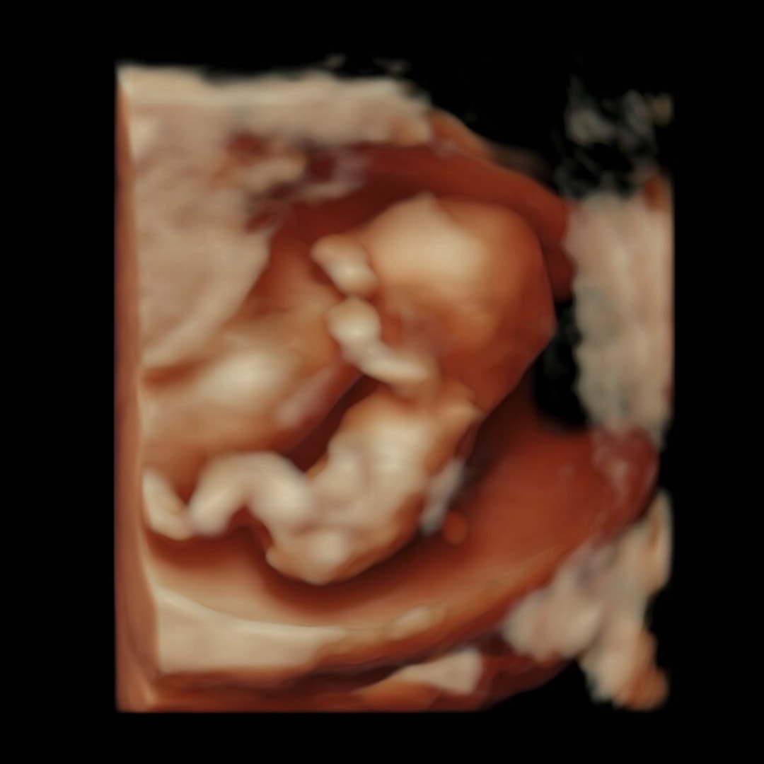 Photo shared by Donna for their Babylist baby registry.