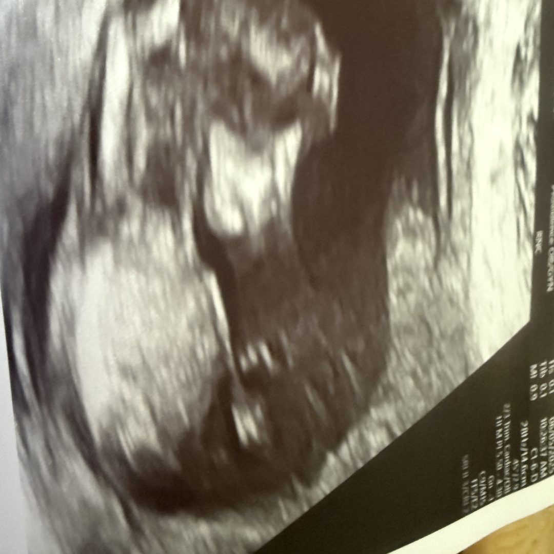 Photo shared by Brit for their Babylist baby registry.