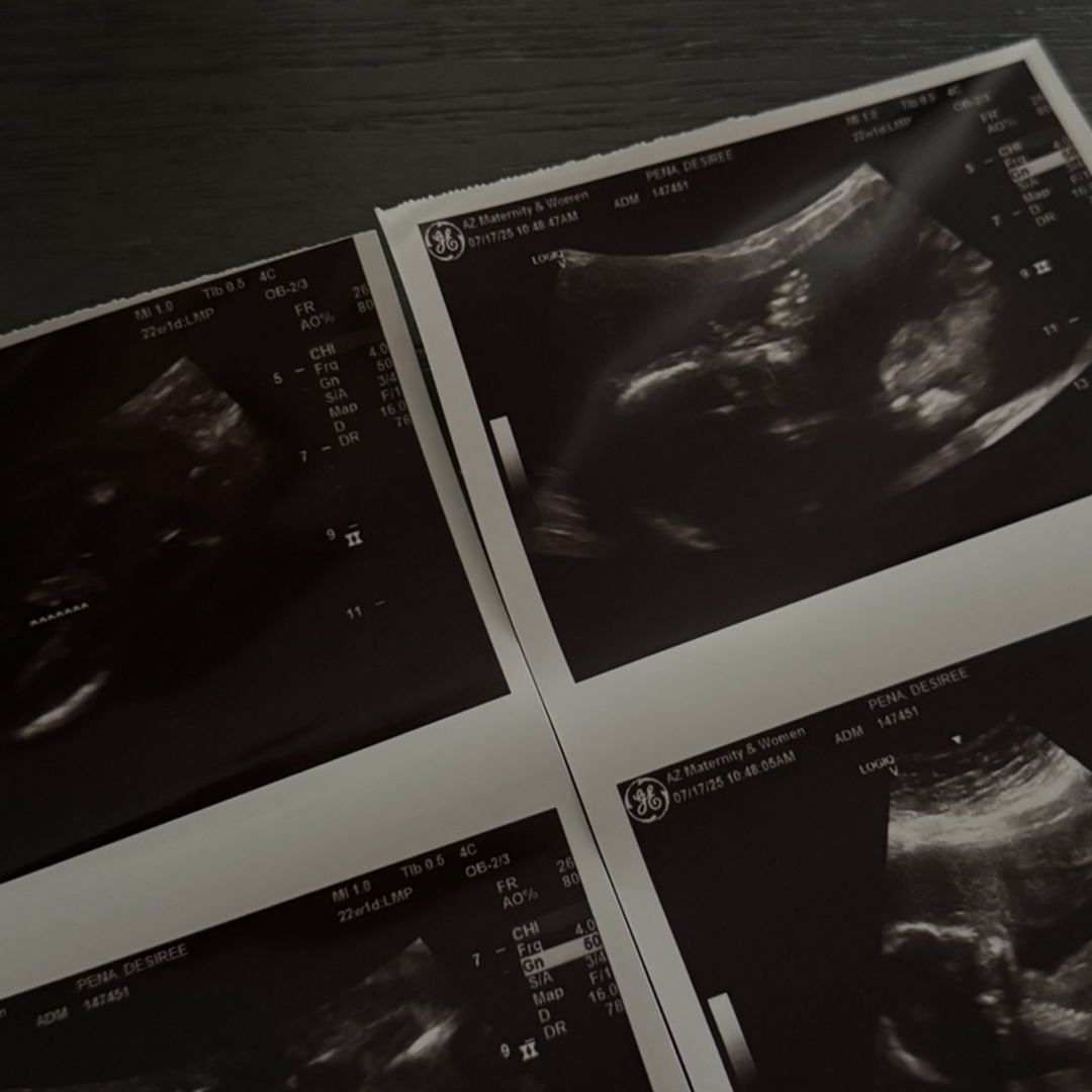 Photo shared by Desiree for their Babylist baby registry.
