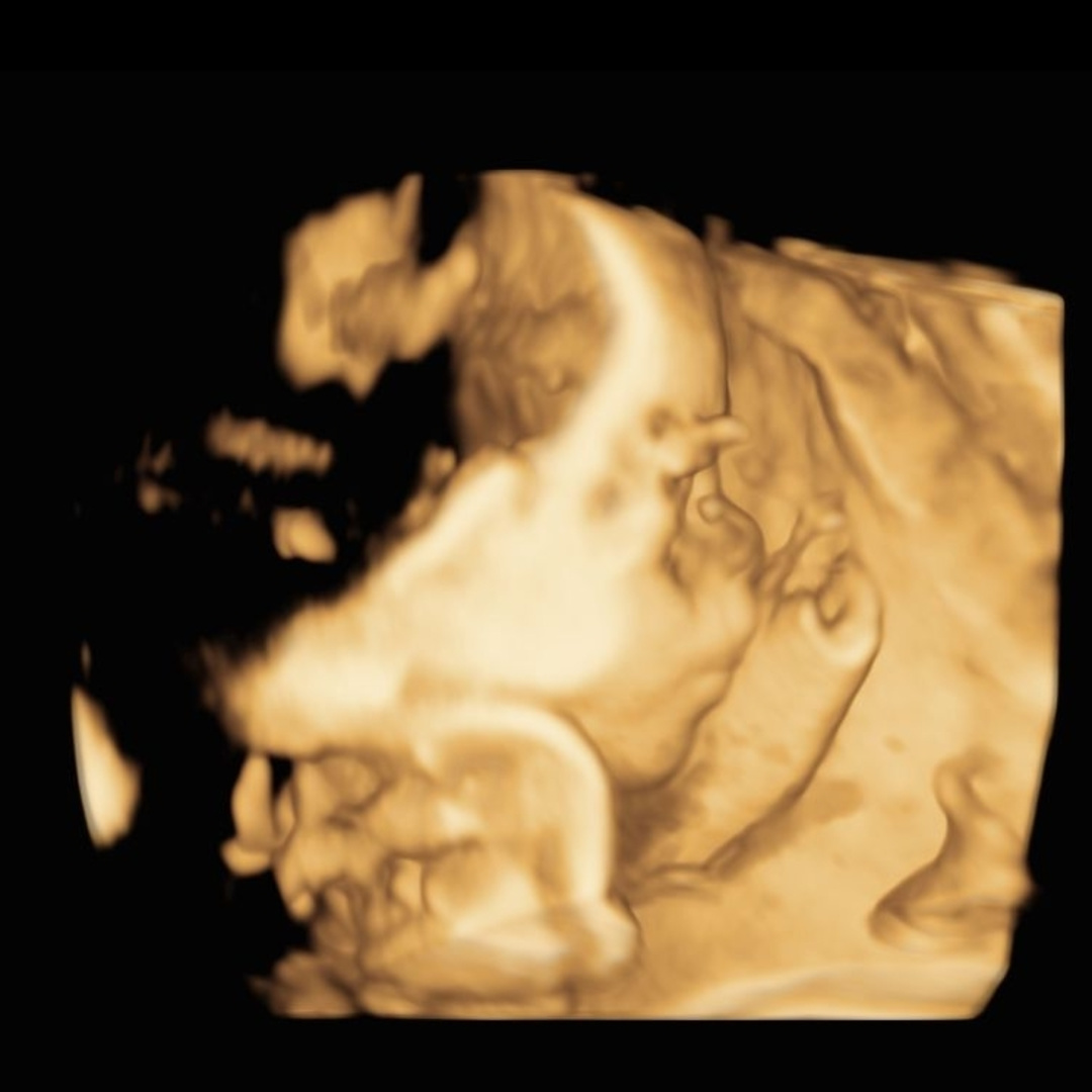 Photo shared by Abigail for their Babylist baby registry.