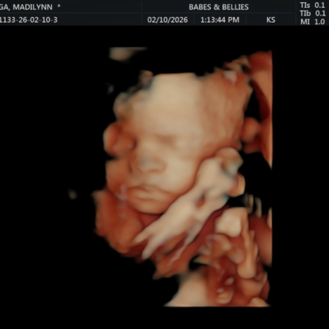 Photo shared by Madilynn & Jerry for their Babylist baby registry.