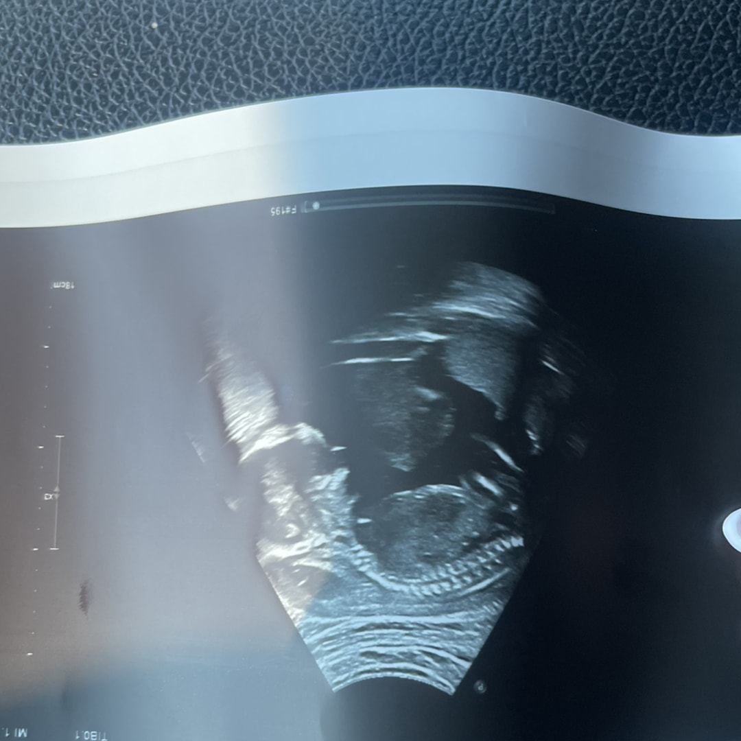 Photo shared by Cristal for their Babylist baby registry.